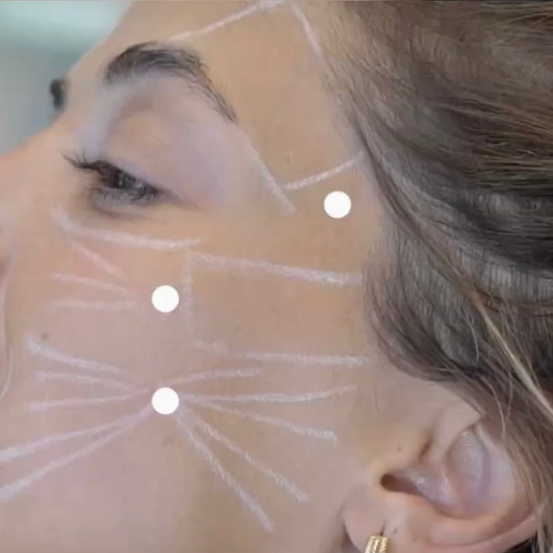 Liquid Facelift - Lifeplus Nisantasi