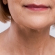 Neck Wrinkles and Medical Solutions - Lifeplus | Nisantasi