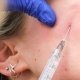 10 Questions About PRP - Lifeplus | Nisantasi